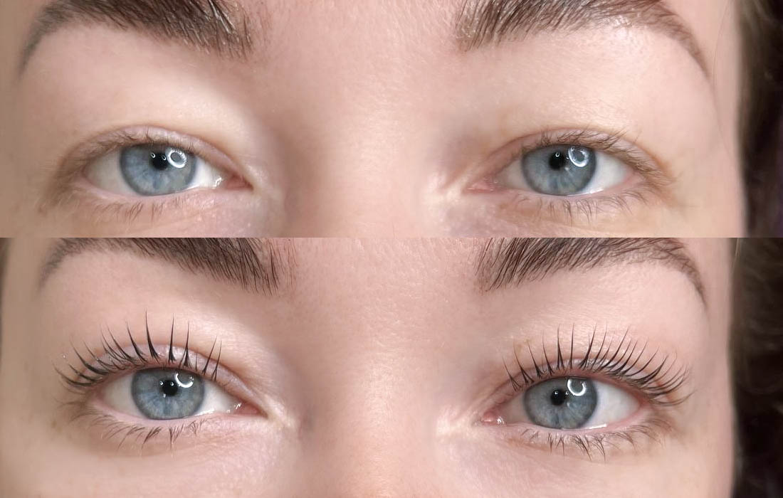 Lash Lift